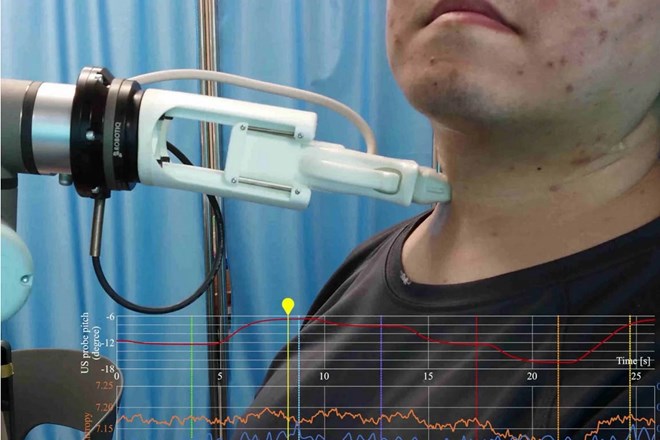 Robot siêu âm AI cho kết quả gần giống với tay nghề bác sĩ